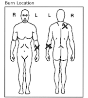 images-zones